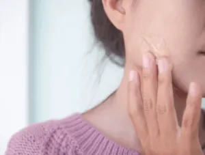 Una giovane ragazza che si spalma della crema aloe sulla guancia
